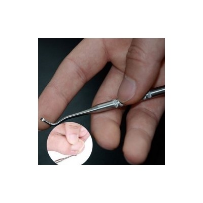 Инструмент для коррекции вросших ногтей