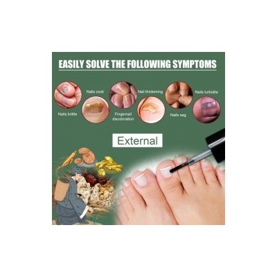 Средство для лечения грибков ногтей Eelhoe