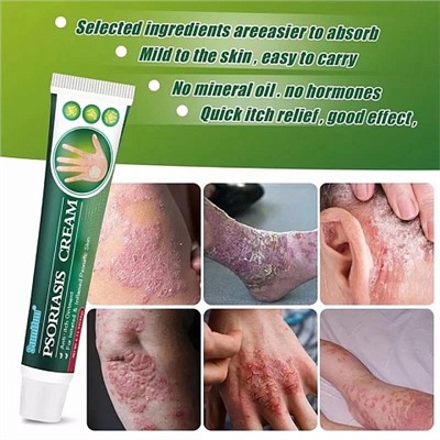 Антибактериальный крем от псориаза, Sumifun Psoriasis cream, 20гр