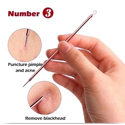 Lanbena Инструменты для чистки лица набор 4шт Acne Blackhead Removal Tool Set