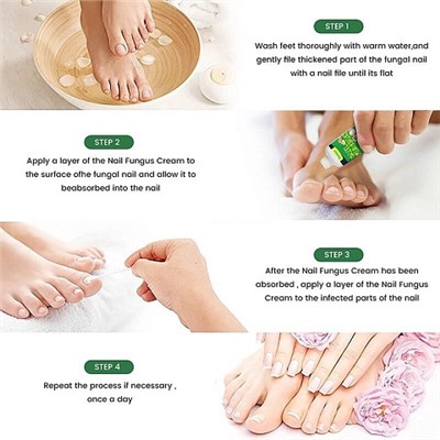 Sumifun Крем для лечения грибка ногтей Nail Fungus cream, 30гр