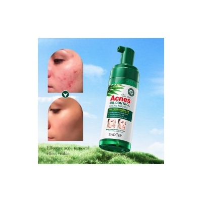 Пенка против Акне Sadoer Tea Tree Acnes Oil Control