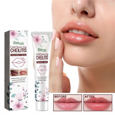 Крем для лечения губ Cold sores lip CHEILITIS, 20гр